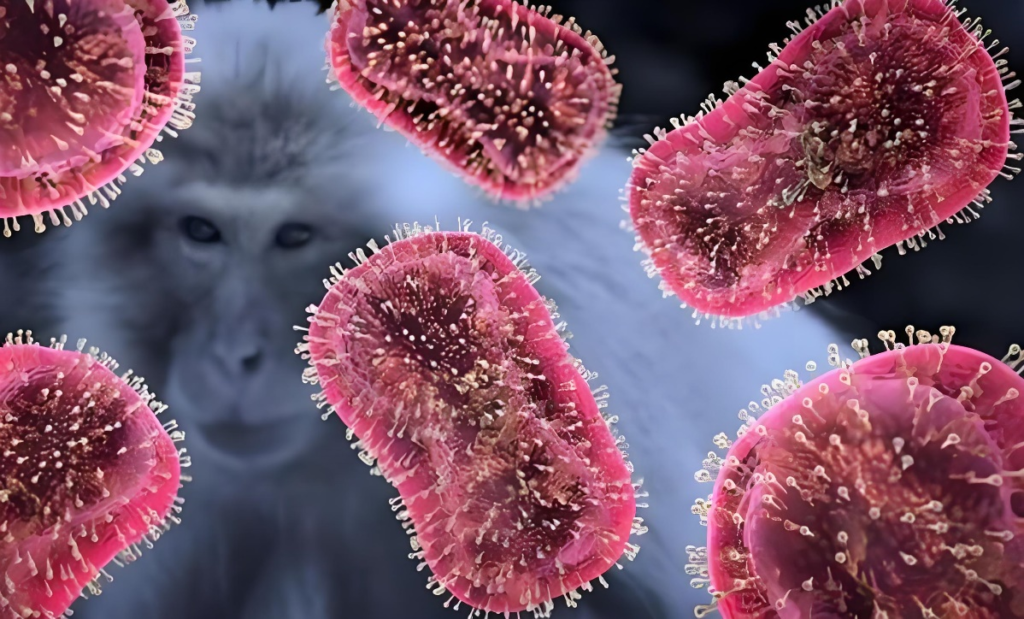 Monkeypox virus, wreaking havoc